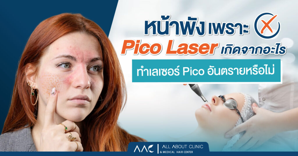 หน้าพังเพราะ Pico Laser เกิดจากอะไร