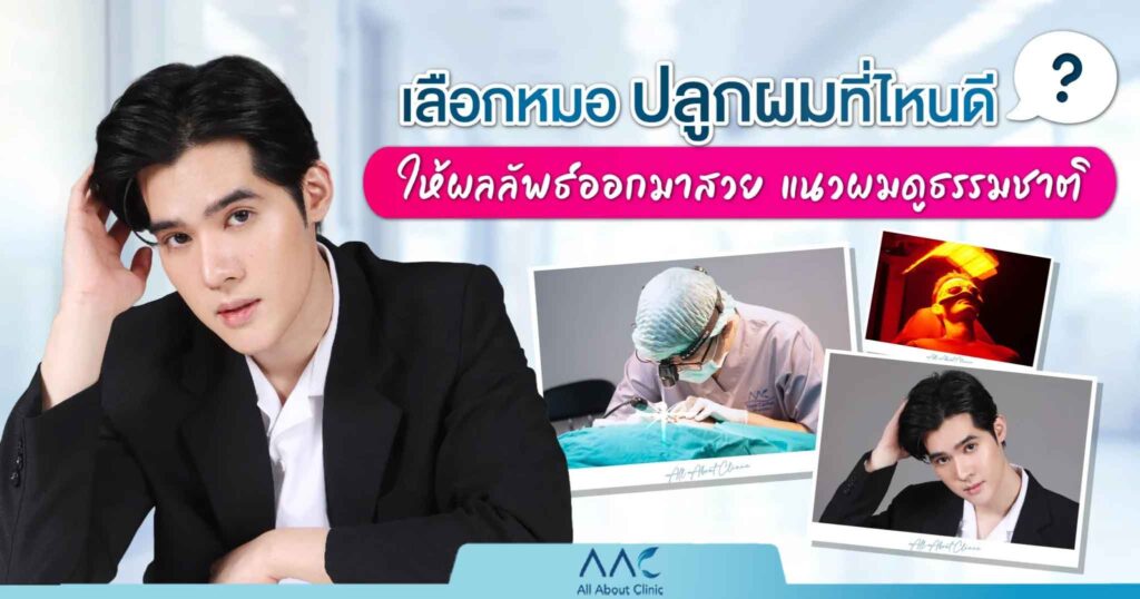 หมอปลูกผม