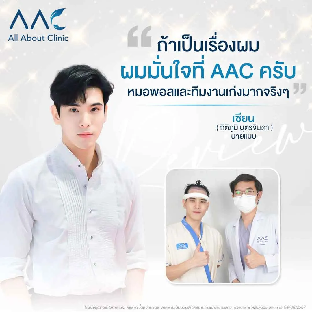 รีวิวปลูกผม คุณเซียน กิติภูมิ นายแบบ ดีกรีผู้บริหารร้านอาหารดัง