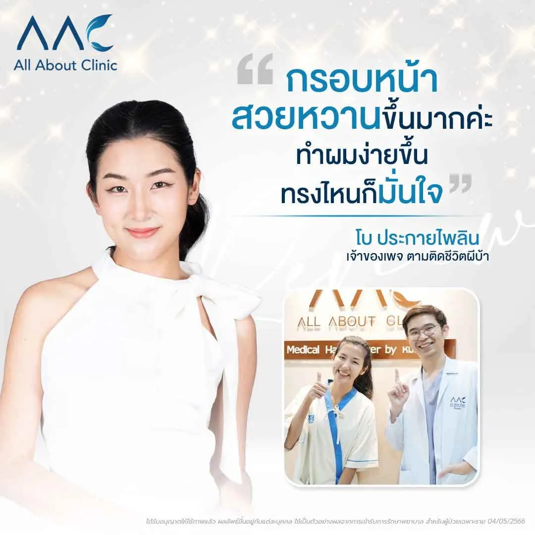 รีวิวปลูกผมผู้หญิง คุณโบ ประกายไพลิน เพจตามติดชีวิตผีบ้า