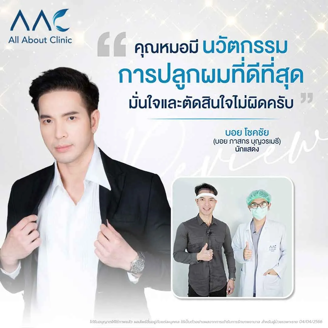รีวิวปลูกผมดาราชาย คุณบอย โชคชัย
