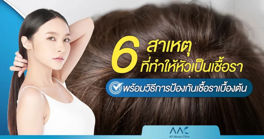 หัวเป็นเชื้อรา