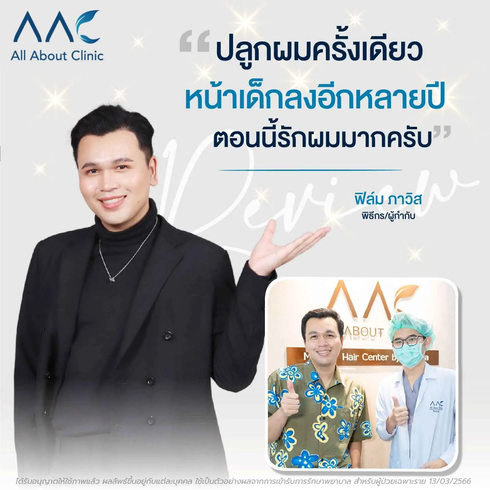 รีวิวปลูกผม คุณฟิล์ม ภาวิส พิธีกรและผู้กำกับ