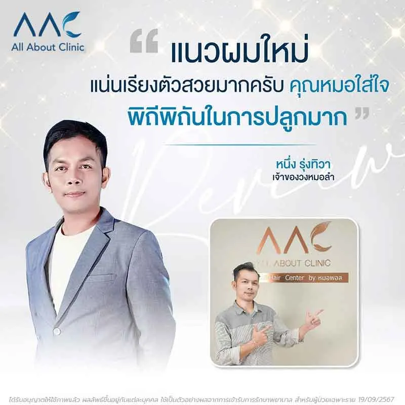 รีวิวหลังปลูกผม คุณหนึ่ง รุ่งทิวา เจ้าของวงหมอลำ