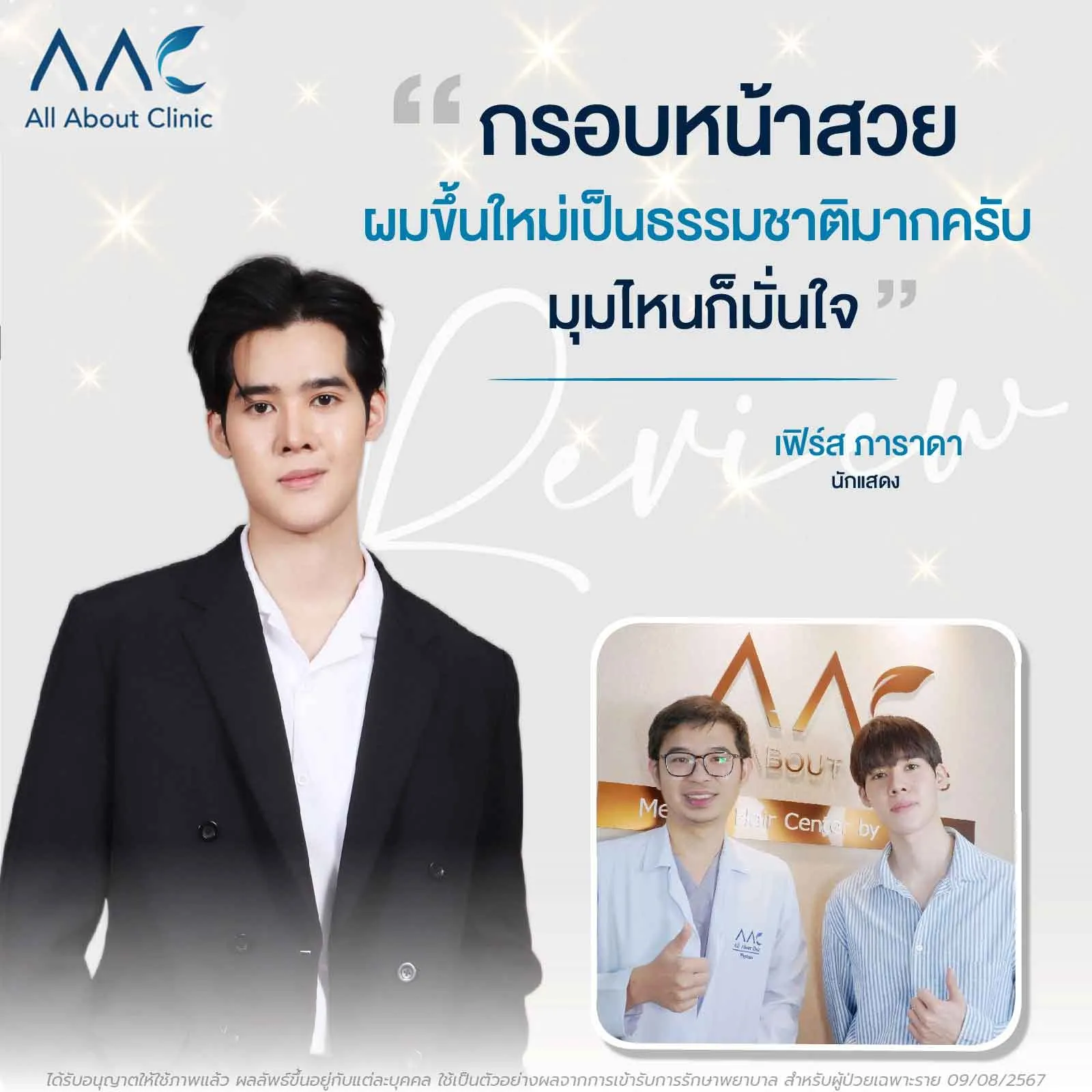 รีวิวปลูกผมดารา คุณเฟิร์ส ภาราดา เทคนิค LEAN