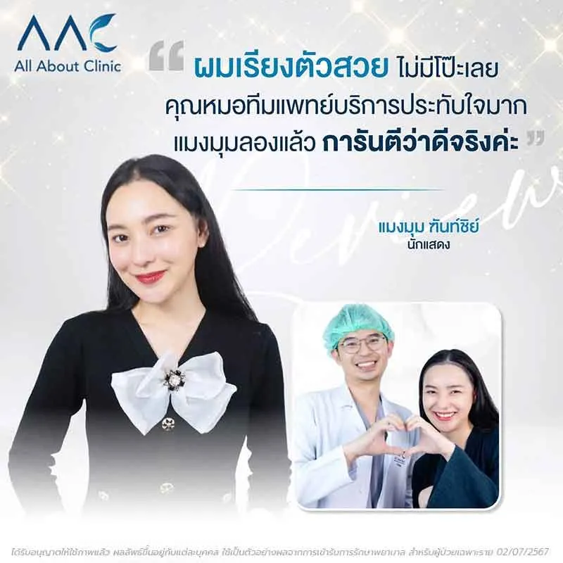 รีวิวปลูกผมดาราสาว คุณแมงมุม ฑันท์ชิย์