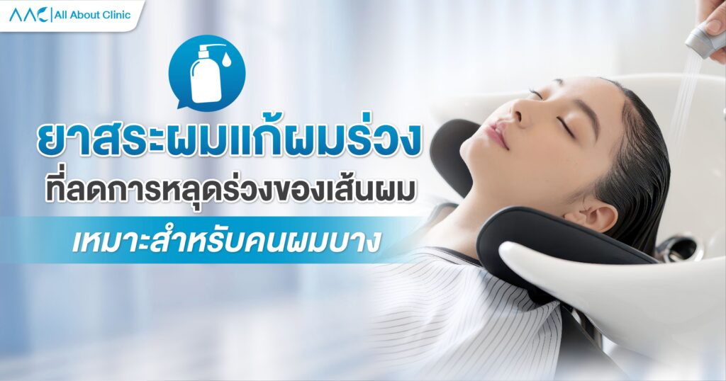 ยาสระผมแก้ผมร่วง