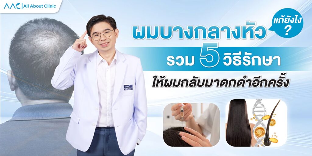 ผมบางกลางหัว