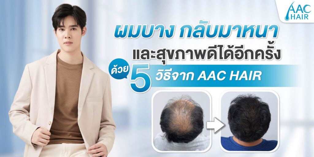 ผมบาง กลับมาหนา
