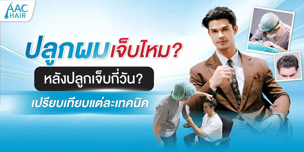 ปลูกผมเจ็บไหม หลังปลูกเจ็บกี่วัน เปรียบเทียบแต่ละเทคนิค